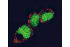 Confocal immunofluorescent analysis of EZH2 antibody and 293 cells followed by Alexa Fluor 488-conjugated goat anti-rabbit lgG (green). (EZH2 抗体)
