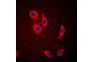 Immunofluorescent analysis of NCKX1 staining in HeLa cells. (SLC24A1 抗体  (Center))