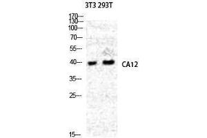 Western Blotting (WB) image for anti-Carbonic Anhydrase 12 (CA12) (Internal Region) antibody (ABIN3180517) (CA12 抗体  (Internal Region))