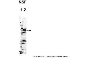 Sample Type: 1. (NSF 抗体  (C-Term))