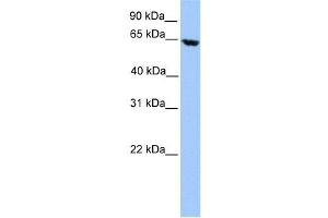 Western Blotting (WB) image for anti-Acyl-CoA Dehydrogenase, Very Long Chain (ACADVL) antibody (ABIN2459763) (ACADVL 抗体)