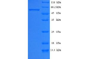SDS-PAGE (SDS) image for Calpain 2 (CAPN2) (AA 1-324), (full length) protein (His-SUMO Tag) (ABIN5709193) (Calpain 2 Protein (CAPN2) (AA 1-324, full length) (His-SUMO Tag))