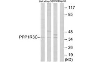 Western blot analysis of extracts from HepG2/HeLa/COS7 cells, using PPP1R3C Antibody.