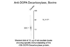 Western blot of DOPA Decarboxylase Bovine Antibody Western Blot of Rabbit anti-DOPA Decarboxylase Bovine Antibody. (DDC 抗体)