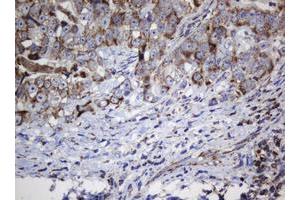 Image no. 5 for anti-NADH Dehydrogenase (Ubiquinone) 1 beta Subcomplex, 10, 22kDa (NDUFB10) antibody (ABIN1499672) (NDUFB10 抗体)