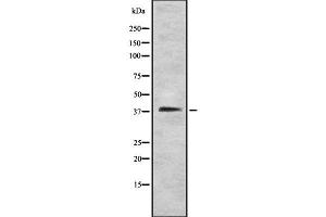 Western blot analysis STEAP1 using HT29 whole cell lysates (STEAP1 抗体  (N-Term))