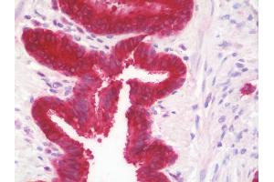 Anti-GGCT antibody IHC staining of human lung. (GGCT 抗体  (AA 139-168))