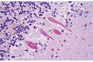 Anti-VLDLR antibody IHC staining of human brain, cerebellum, Purkinje. (VLDLR 抗体)