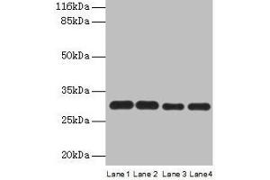 Western blot All lanes: PMM1 antibody at 2 μg/mL Lane 1: HepG2 whole cell lysate Lane 2: NIH/3T3 whole cell lysate Lane 3: 293T whole cell lysate Lane 4: Mouse brain tissue Secondary Goat polyclonal to rabbit IgG at 1/10000 dilution Predicted band size: 30 kDa Observed band size: 30 kDa (PMM1 抗体  (AA 2-262))