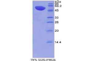 SDS-PAGE analysis of Mouse MX1 Protein. (MX1 蛋白)