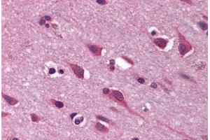 anti-Nephroblastoma Overexpressed (NOV) (C-Term) antibody