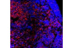 Immunofluorescence of paraffin embedded mouse lymph node using septin1 (ABIN7074453) at dilution of 1: 650 (400x lens)