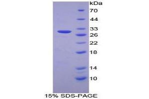 SDS-PAGE analysis of Human PSMD2 Protein. (PSMD2 蛋白)