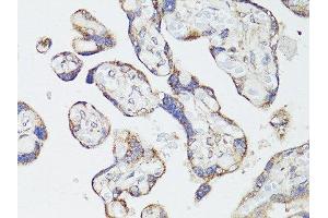 Immunohistochemistry of paraffin-embedded human placenta using MTOR antibody. (MTOR 抗体  (AA 2388-2487))