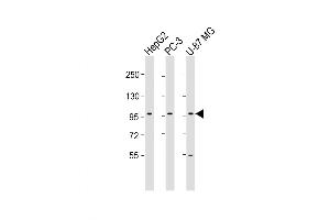 Western Blot at 1:1000-1:2000 dilution Lane 1: HepG2 whole cell lysate Lane 2: PC-3 whole cell lysate Lane 3: U-87 MG whole cell lysate Lysates/proteins at 20 ug per lane.