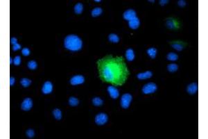 Anti-PSMD2 mouse monoclonal antibody (ABIN2454820) immunofluorescent staining of COS7 cells transiently transfected by pCMV6-ENTRY PSMD2 (RC203204). (PSMD2 抗体)
