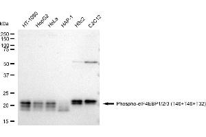 Western blotting analysis using Phospho-eIF4EBP1/2/3 (T46+T46+T32) antibody (ABIN7798429).