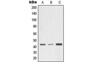 Western blot analysis of MMP3 expression in A549 (A), MCF7 (B), rat heart (C) whole cell lysates. (MMP3 抗体  (Center))