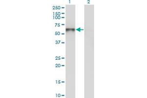 Western Blot analysis of UNC5CL expression in transfected 293T cell line by UNC5CL monoclonal antibody (M03), clone 3G7. (UNC5CL 抗体  (AA 1-518))