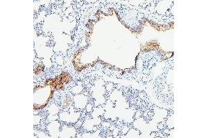 IHC analysis of TEK using anti-TEK antibody (ABIN7600762). (TEK 抗体  (AA 23-616))