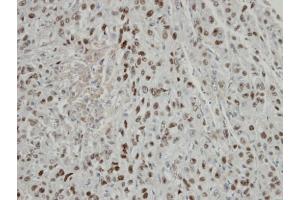 IHC-P Image Immunohistochemical analysis of paraffin-embedded Mahlavu xenograft, using COPS2, antibody at 1:100 dilution. (COPS2 抗体  (C-Term))