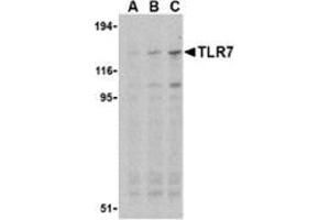 Western blot analysis of TLR7 in Daudi cell lysates with this product at (A) 0. (TLR7 抗体  (Middle Region))