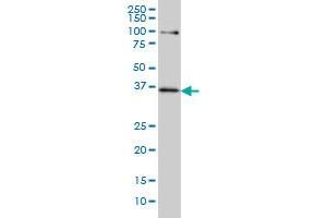 Western Blotting (WB) image for anti-Transcription Factor 19 (TCF19) (AA 17-103) antibody (ABIN598965) (TCF19 抗体  (AA 17-103))