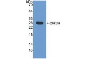 Detection of Recombinant ICOSLG, Mouse using Polyclonal Antibody to Inducible T-Cell Co Stimulator Ligand (ICOSLG) (ICOSLG 抗体  (AA 58-249))