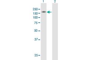 Western Blotting (WB) image for anti-Sema Domain, Transmembrane Domain (TM), and Cytoplasmic Domain, (Semaphorin) 6A (SEMA6A) (AA 1-1030) antibody (ABIN528227)