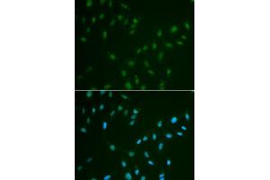 Immunofluorescence analysis of A549 cell using HSF2 antibody. (HSF2 抗体)