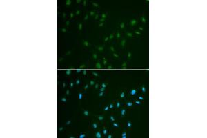Immunofluorescence analysis of A549 cell using HSF2 antibody. (HSF2 抗体)