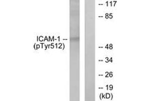 Western blot analysis of extracts from HeLa cells treated with TNF-alpha 20ng/ml 5', using ICAM-1 (Phospho-Tyr512) Antibody. (ICAM1 抗体  (pTyr512))