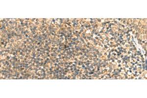 Immunohistochemistry of paraffin-embedded Human tonsil tissue using TCAP Polyclonal Antibody at dilution of 1:55(x200) (TCAP 抗体)