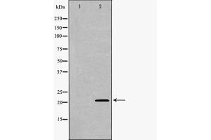 Western blot analysis UBE2M using COLO205 whole cell lysates (UBE2M 抗体  (Internal Region))