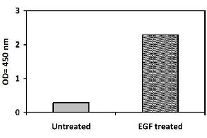 Image no. 3 for Epidermal Growth Factor Receptor (EGFR) ELISA Kit (ABIN1981784) (EGFR ELISA 试剂盒)