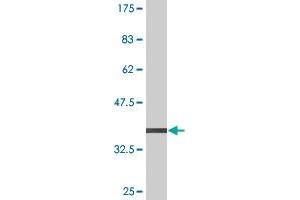 Western Blot detection against Immunogen (38. (SH2D3A 抗体  (AA 460-575))