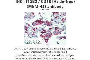 Image no. 1 for anti-Integrin beta 2 (ITGB2) antibody (ABIN1723416) (Integrin beta 2 抗体)