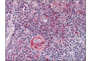 Immunohistochemistry: WNT5B antibody staining of Formalin-Fixed, Paraffin-Embedded Human Thymus.