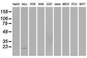 Image no. 2 for anti-Adenylate Kinase 1 (AK1) antibody (ABIN1496514) (Adenylate Kinase 1 抗体)