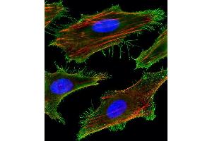 Fluorescent image of Hela cells stained with FA Antibody (Center) (ABIN1881332 and ABIN2843378). (FAM159A 抗体  (AA 89-115))