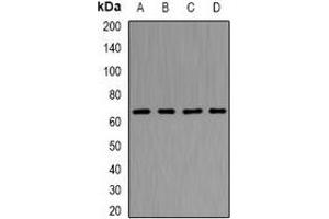 Western blot analysis of NUP62 expression in Hela (A), Jurkat (B), HT29 (C), Raji (D) whole cell lysates. (NUP62 抗体)
