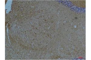 Immunohistochemistry (IHC) image for anti-Potassium Voltage-Gated Channel, Subfamily H (Eag-Related), Member 7 (KCNH7) antibody (ABIN3188071)