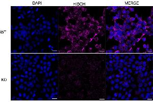Immunocytochemical staining of HeLa cells using HIBCH antibody (ABIN7797421), 1:1,000), Top panel: wild-type (WT), Bottom panal: HIBCH shRNA knockdown (KD).