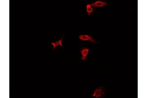 ABIN6277935 staining HepG2? (PRMT7 抗体  (Internal Region))
