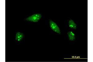 Immunofluorescence of monoclonal antibody to MEOX1 on HeLa cell. (MEOX1 抗体  (AA 165-252))