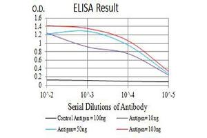 Black line: Control Antigen (100 ng),Purple line: Antigen (10 ng), Blue line: Antigen (50 ng), Red line:Antigen (100 ng)