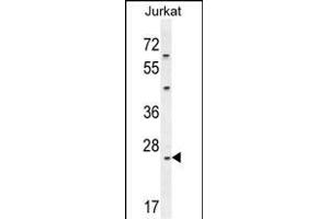 CLDN22 Antibody (Center) (ABIN654190 and ABIN2844042) western blot analysis in Jurkat cell line lysates (35 μg/lane). (Claudin 22 (CLDN22) (AA 90-117) 抗体)