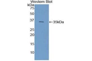 Western Blotting (WB) image for anti-Ficolin (Collagen/fibrinogen Domain Containing) 1 (FCN1) (AA 25-317) antibody (ABIN3207865) (FCN1 抗体  (AA 25-317))