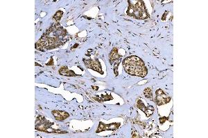 IHC analysis of SAP130 using anti-SAP130 antibody (ABIN7601247).