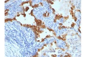 anti-Nuclear Membrane antibody